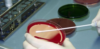 Infecciones bacterianas del tracto reproductivo masculino y su papel en la fertilidad