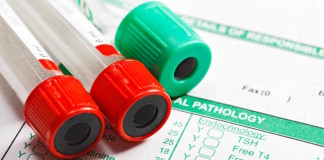Cholesterol Testing: Is Fasting Necessary?