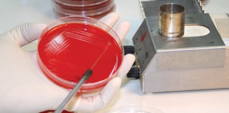 Bacteria with Antibiotic Resistance MCR-1 Gene Found for the First Time in U.S. Patient, Raises Concern