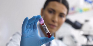 Anticuerpos Anti-Nucleocitoplasmáticos: ¿Cuándo deben ser solicitados?