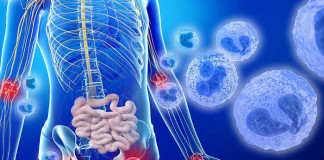 Otulipenia, a new inflammatory disease