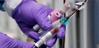 Panel de Esclerodermia asociado a Colágenopatías