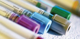 Actualización del Laboratorio en la Artritis Reumatoidea