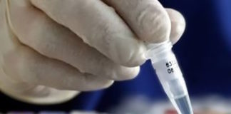 Un análisis de saliva podría diagnosticar el asma