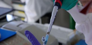 El VIH favorecería el desarrollo de algunas enfermedades autoinmunes