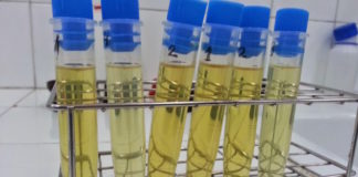 Valor del sedimento urinario en el diagnóstico de Malacoplaquia