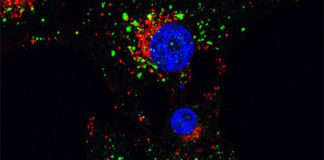 A través del reciclaje celular un cannabinoide acaba con células tumorales
