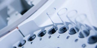 Enfermedad neurológica asociada a un coronavirus