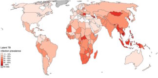 El mapa de la tuberculosis oculta
