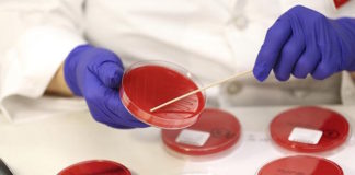 La celulitis mal diagnosticada conduce al uso de antibióticos y a hospitalizaciones sin que esto sea necesario