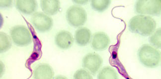 Hackear el Chagas: nuevos métodos de diagnóstico para el Chagas