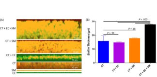 El hongo Candida tropicalis podría ser un factor clave en el desarrollo de la enfermedad de Crohn en humanos