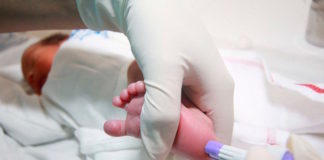 Cribado neonatal actual para citomegalovirus congénito: ¿cribado universal?