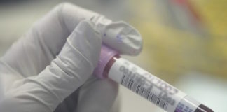 Iron deficiency testing deficient in ulcerative colitis