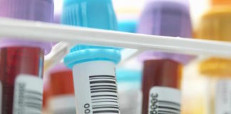 Routine blood test predicts how long cancer patients will survive