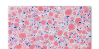 La proteína CPEB4 brinda protección contra el hígado graso