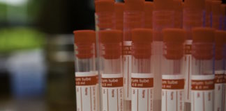 Los medicamentos para el VIH podrían aumentar la susceptibilidad a la sífilis