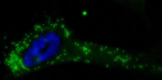 Study unveils new way to starve tumors to death