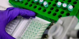 Uso del pepsinógeno en suero para diagnóstico de gastritis atrófica