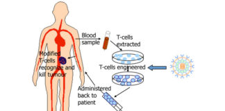 Chimeric Antigen Receptor T-Cell Therapy: How it Works