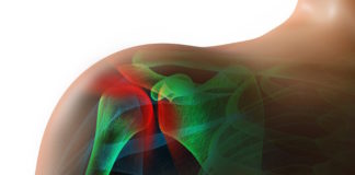 Bone markers as screening strategy for patient adherence to osteoporosis medications