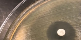 Antimicrobial Susceptibility Testing for new antibiotics: the clinical laboratorian’s dilemma