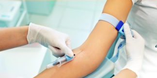 Los haplotipos de metilación CpG podrían ayudar a detectar la ubicación de tumores