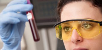 Lipocalina asociada con la gelatinasa de neutrófilos, un nuevo marcador de lesión renal aguda en el enfermo grave