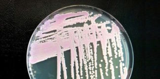El hongo Candida auris amenaza la salud global