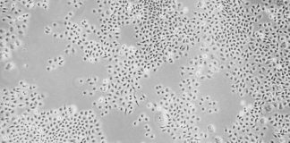 New approach makes cells resistant to HIV