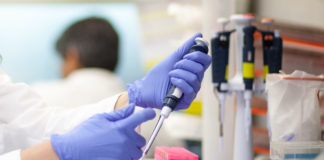 Detección del Anticoagulante Lúpico en el laboratorio