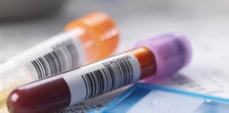 Beneficios del asesoramiento Bioquímico