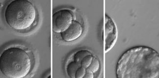 Se utiliza por primera vez CRISPR para modificar embriones humanos con cardiomiopatía hipertrófica