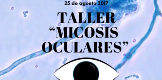 Taller: Micosis oculares