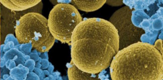 La importación ilegal de alimentos ayuda a propagar Staphylococcus aureus