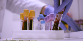 El significado de los Anticuerpos anti-DFS70 en la exclusión de Enfermedades Autoinmunes Sistémicas Reumáticas (SARD)