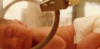 Péptido natriurético tipo B: utilidad en el manejo de recién nacidos críticamente enfermos