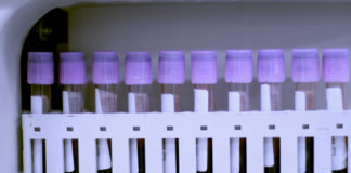 Residuos de Pesticidas en sangre: una revisión de casos en el mundo