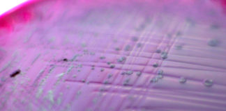 Las bacterias de una infección proliferan de forma organizada, con asignación de tareas