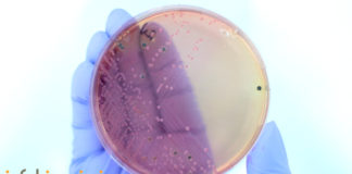 Métodos de identificación bacteriana en el laboratorio de microbiología