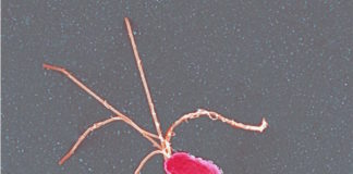 Investigadores descubren un nuevo mecanismo por el que la bacteria Helicobacter pylori puede causar cáncer gástrico