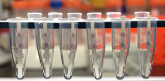 El virus Zika podría causar abortos incluso en mujeres sin síntomas