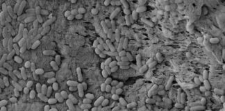 Científicas del CONICET proponen método biológico para frenar a un patógeno de las heladeras