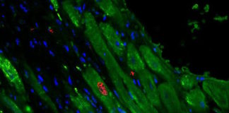 Un gel inyectable que libera microARNs para regenerar el músculo cardiaco