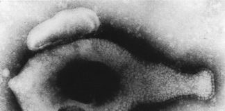 Mycoplasma genitalium, una bacteria de transmisión sexual difícil de diagnosticar y de tratar