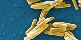 Descubren en Europa una nueva cepa de tuberculosis multirresistente en refugiados llegados del Cuerno de África
