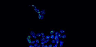 Una proteína mantiene dormidas las células metastásicas del cáncer de mama