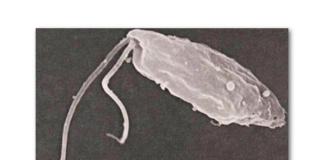 Primer registro humano de meningoencefalitis amebiana primaria por Naegleria fowleri en Argentina