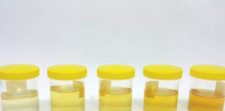 Una molécula relacionada con el estrés oxidativo permitiría monitorizar el proceso de senectud