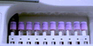 Se resuelven las bases genéticas del último tipo de grupo sanguíneo